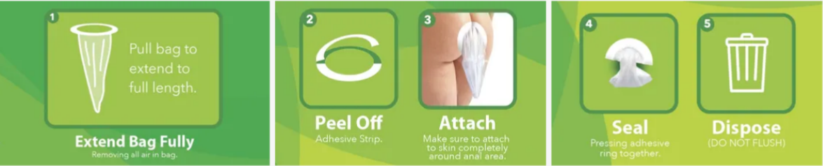 Bowel Bag product instructions — 5 step diagram